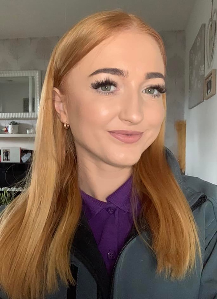 She is using her experience with sepsis to educate others about Crohn's disease.