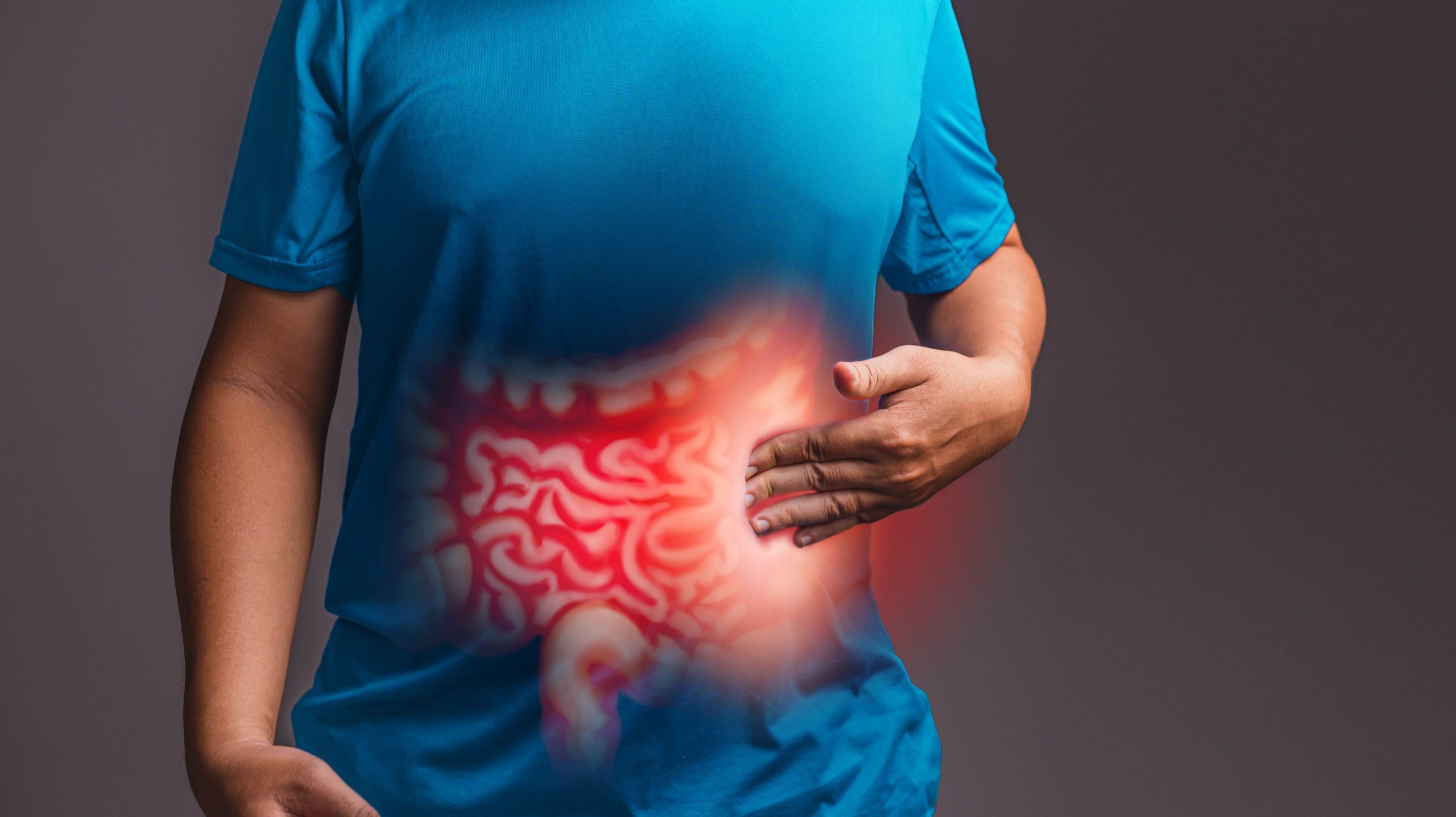 Analysis of SSRIs and gut microbiota in major depressive disorder
