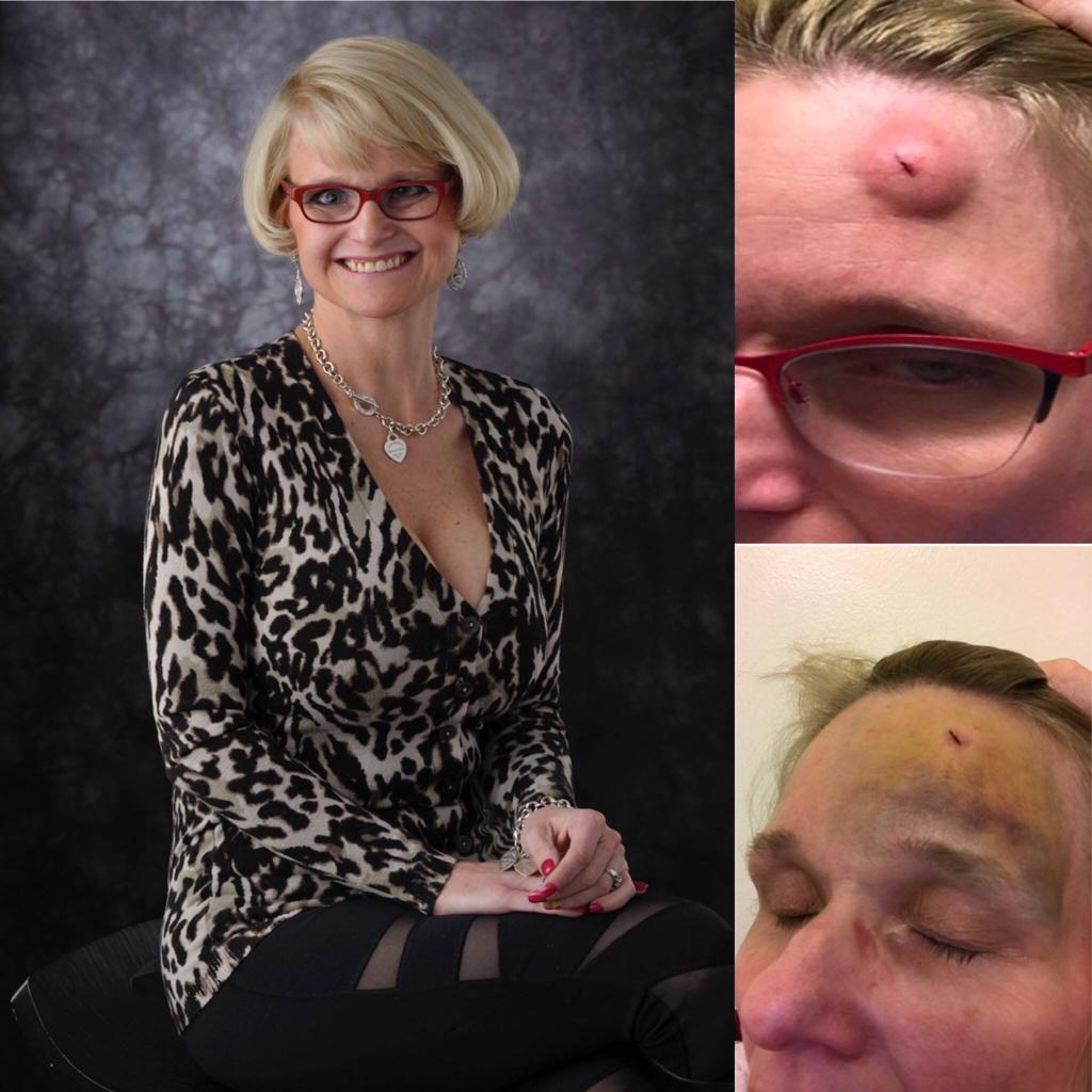 Nikki Lawley shows her injuries